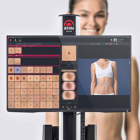 FotoFinder Bodystudio Automated Total Body Mapping system