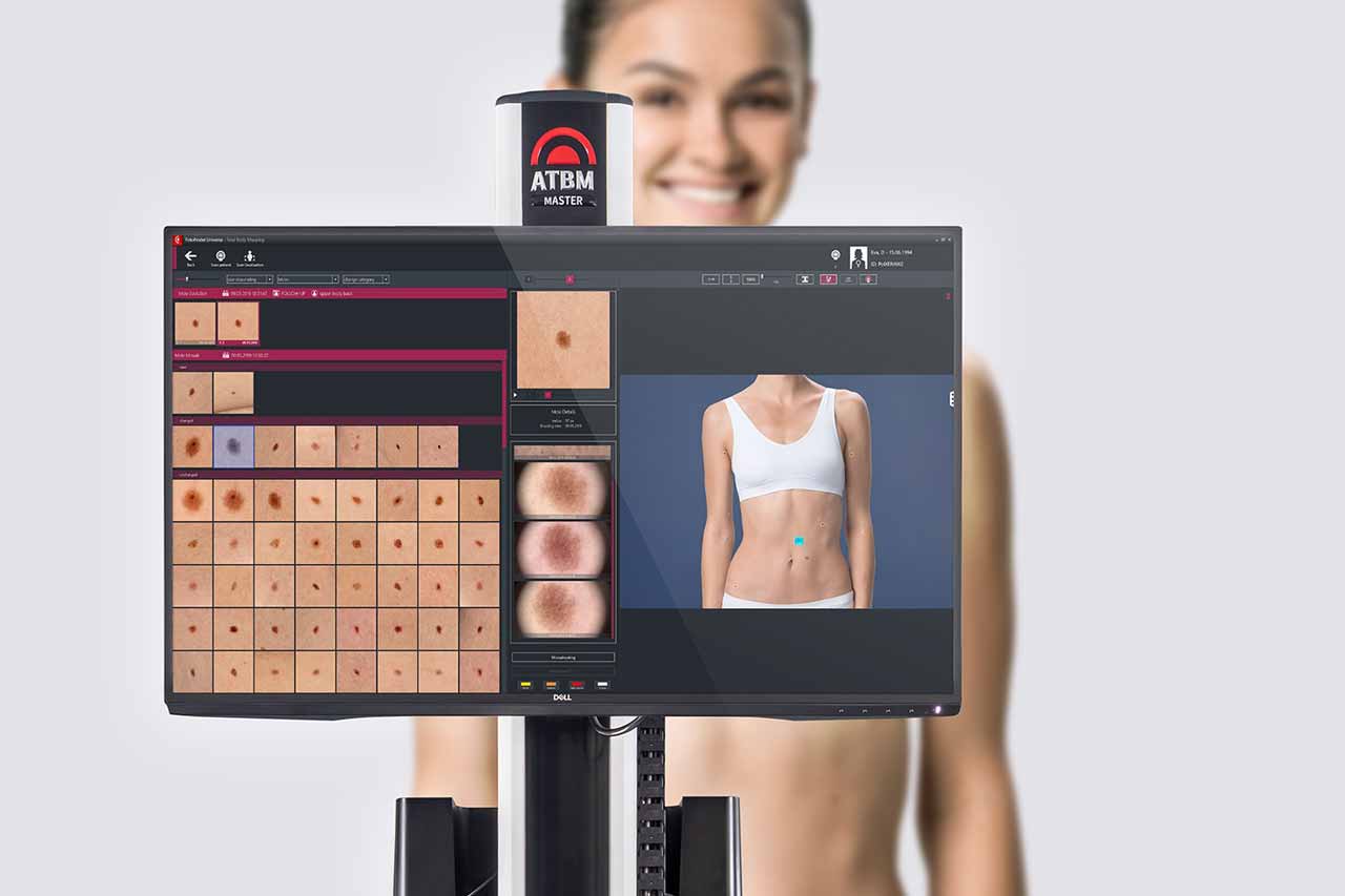 FotoFinder Bodystudio Automated Total Body Mapping system interface