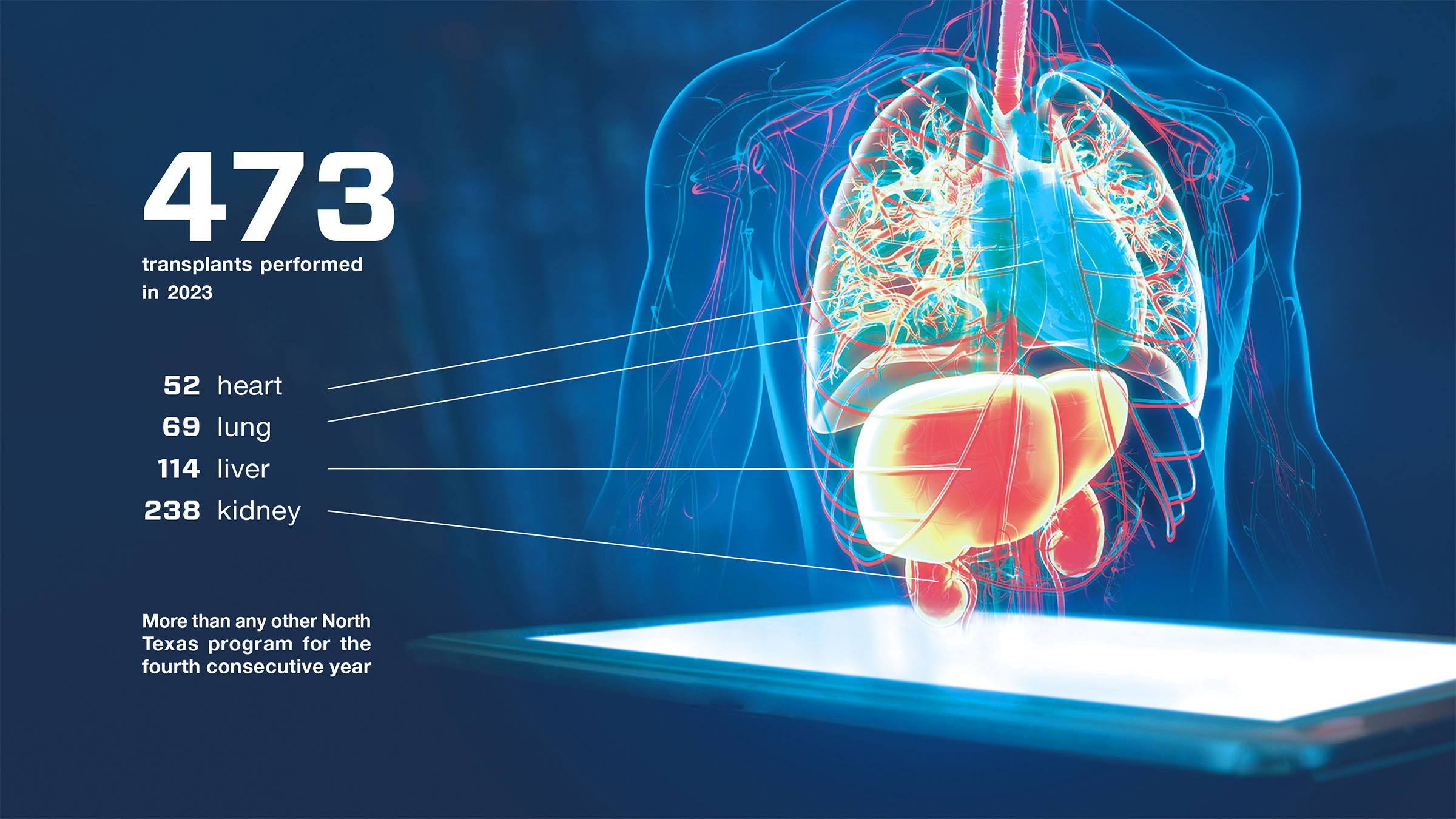 An illustration of the heart, lung, liver, and kidney with text saying '473 transplants performed in 2023. 52 heart. 69 lung. 114 liver. 238 kidney. More than any other North Texas program for the fourth consecutive year'.